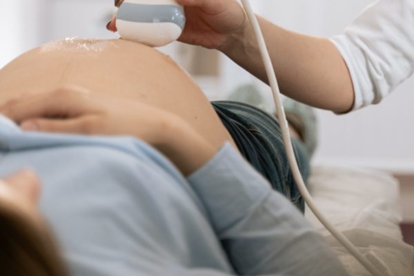 A pregnant woman gets an ultrasound