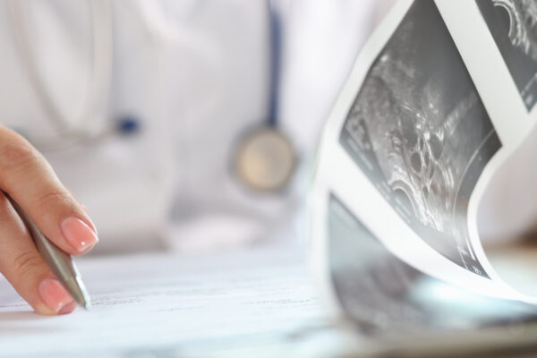 A female doctor looks at an ultrasound and paperwork, representing early pregnancy payment demands.